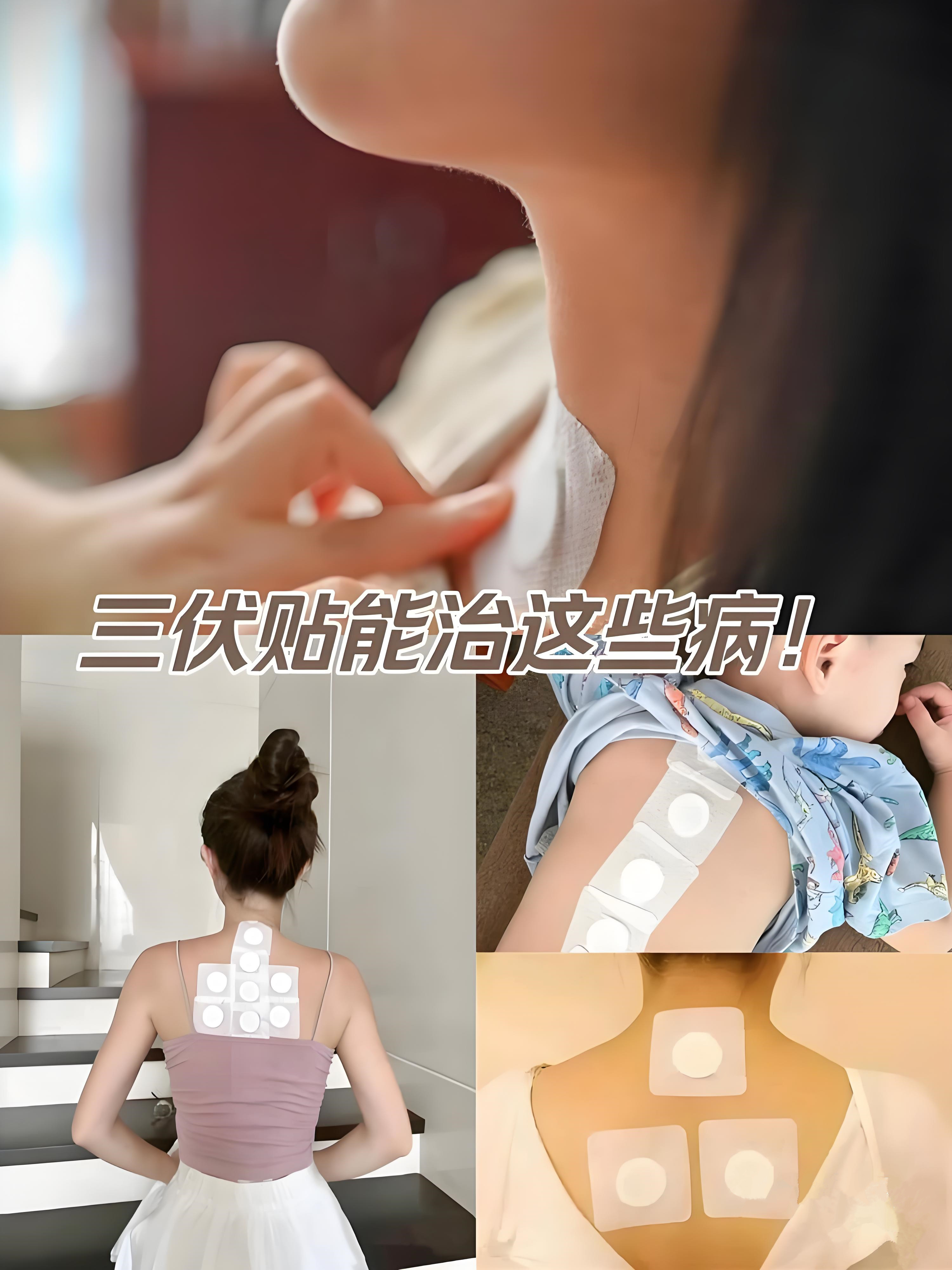 三伏贴的神奇作用